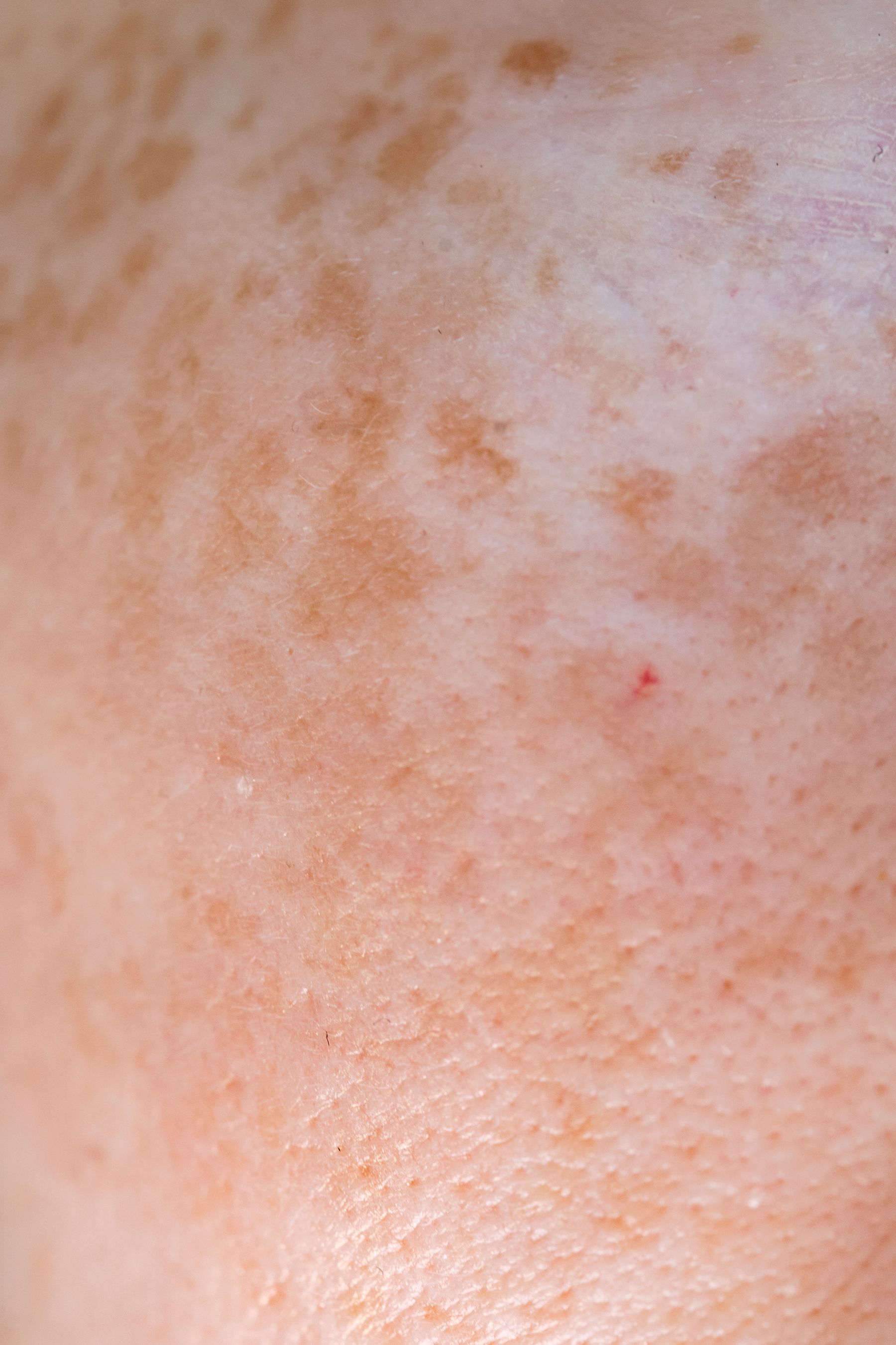 Skin close-up