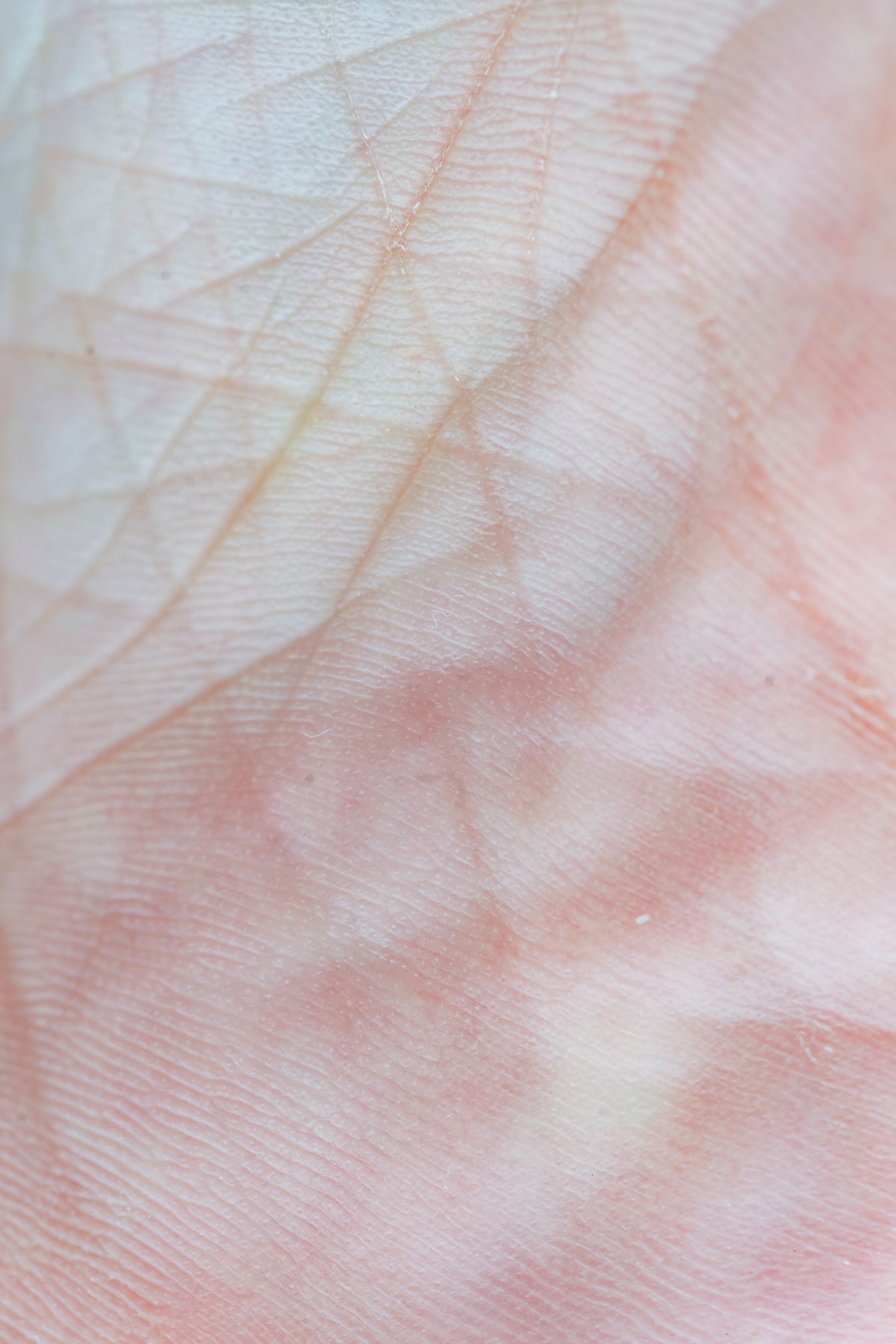 Skin texture
