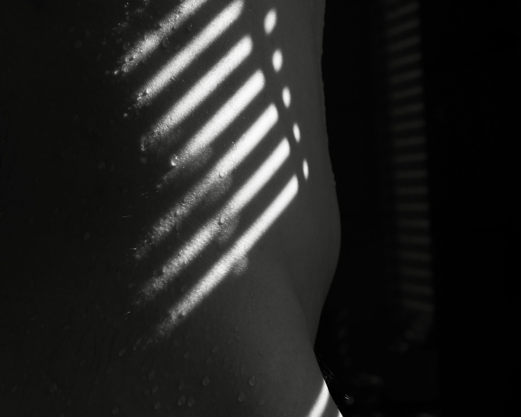 Chemical peels
